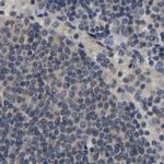 RUVBL1 Antibody in Immunohistochemistry (Paraffin) (IHC (P))