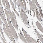 RUVBL1 Antibody in Immunohistochemistry (Paraffin) (IHC (P))