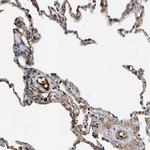 Complement C3 Antibody in Immunohistochemistry (Paraffin) (IHC (P))