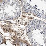 Complement C3 Antibody in Immunohistochemistry (Paraffin) (IHC (P))