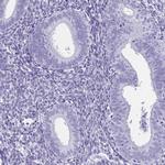 SCP1 Antibody in Immunohistochemistry (Paraffin) (IHC (P))