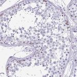 SCP1 Antibody in Immunohistochemistry (Paraffin) (IHC (P))