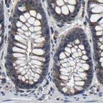 RCAS1 Antibody in Immunohistochemistry (Paraffin) (IHC (P))