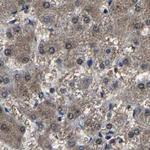 RCAS1 Antibody in Immunohistochemistry (Paraffin) (IHC (P))