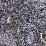 RCAS1 Antibody in Immunohistochemistry (Paraffin) (IHC (P))