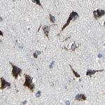 RCAS1 Antibody in Immunohistochemistry (Paraffin) (IHC (P))