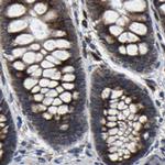 RCAS1 Antibody in Immunohistochemistry (Paraffin) (IHC (P))