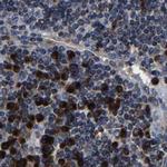 RCAS1 Antibody in Immunohistochemistry (Paraffin) (IHC (P))