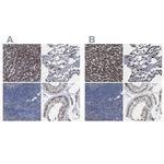 HSD17B4 Antibody in Immunohistochemistry (Paraffin) (IHC (P))