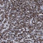 HSD17B4 Antibody in Immunohistochemistry (Paraffin) (IHC (P))