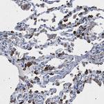 HSD17B4 Antibody in Immunohistochemistry (Paraffin) (IHC (P))