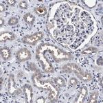 CALCOCO2 Antibody in Immunohistochemistry (Paraffin) (IHC (P))