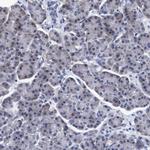 CALCOCO2 Antibody in Immunohistochemistry (Paraffin) (IHC (P))