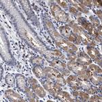 CALCOCO2 Antibody in Immunohistochemistry (Paraffin) (IHC (P))