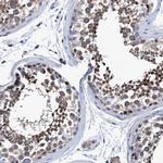 CALCOCO2 Antibody in Immunohistochemistry (Paraffin) (IHC (P))