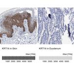 Cytokeratin 14 Antibody in Immunohistochemistry (Paraffin) (IHC (P))