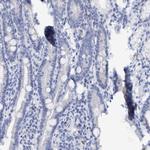 Cytokeratin 14 Antibody in Immunohistochemistry (Paraffin) (IHC (P))