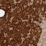 ZBTB2 Antibody in Immunohistochemistry (Paraffin) (IHC (P))