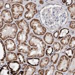 DECR1 Antibody in Immunohistochemistry (Paraffin) (IHC (P))