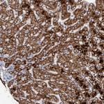 DECR1 Antibody in Immunohistochemistry (Paraffin) (IHC (P))