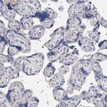 DECR1 Antibody in Immunohistochemistry (Paraffin) (IHC (P))