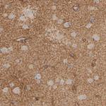 PIST Antibody in Immunohistochemistry (Paraffin) (IHC (P))