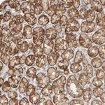 PIST Antibody in Immunohistochemistry (Paraffin) (IHC (P))