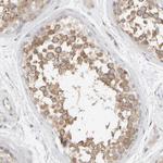 PIST Antibody in Immunohistochemistry (Paraffin) (IHC (P))