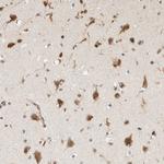 HRD1 Antibody in Immunohistochemistry (Paraffin) (IHC (P))