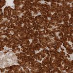 HRD1 Antibody in Immunohistochemistry (Paraffin) (IHC (P))