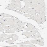 HRD1 Antibody in Immunohistochemistry (Paraffin) (IHC (P))