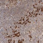 HRD1 Antibody in Immunohistochemistry (Paraffin) (IHC (P))