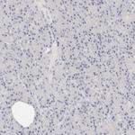 CD22 Antibody in Immunohistochemistry (Paraffin) (IHC (P))