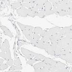 CD22 Antibody in Immunohistochemistry (Paraffin) (IHC (P))