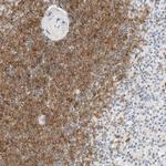 CD22 Antibody in Immunohistochemistry (Paraffin) (IHC (P))