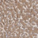 ACAT2 Antibody in Immunohistochemistry (Paraffin) (IHC (P))