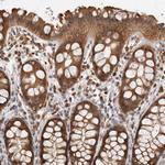 ACAT2 Antibody in Immunohistochemistry (Paraffin) (IHC (P))