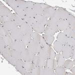 ACAT2 Antibody in Immunohistochemistry (Paraffin) (IHC (P))