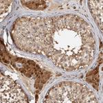 ACAT2 Antibody in Immunohistochemistry (Paraffin) (IHC (P))