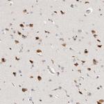 TCF4 Antibody in Immunohistochemistry (Paraffin) (IHC (P))