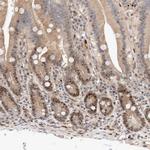 TCF4 Antibody in Immunohistochemistry (Paraffin) (IHC (P))