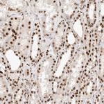 TCF4 Antibody in Immunohistochemistry (Paraffin) (IHC (P))