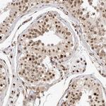 TCF4 Antibody in Immunohistochemistry (Paraffin) (IHC (P))