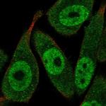 RAD23A Antibody in Immunocytochemistry (ICC/IF)