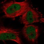 UHRF2 Antibody in Immunocytochemistry (ICC/IF)