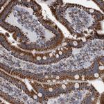 MDH2 Antibody in Immunohistochemistry (Paraffin) (IHC (P))