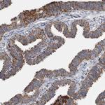 MDH2 Antibody in Immunohistochemistry (Paraffin) (IHC (P))