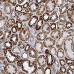 MDH2 Antibody in Immunohistochemistry (Paraffin) (IHC (P))