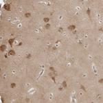 14-3-3 gamma Antibody in Immunohistochemistry (Paraffin) (IHC (P))