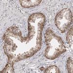 14-3-3 gamma Antibody in Immunohistochemistry (Paraffin) (IHC (P))